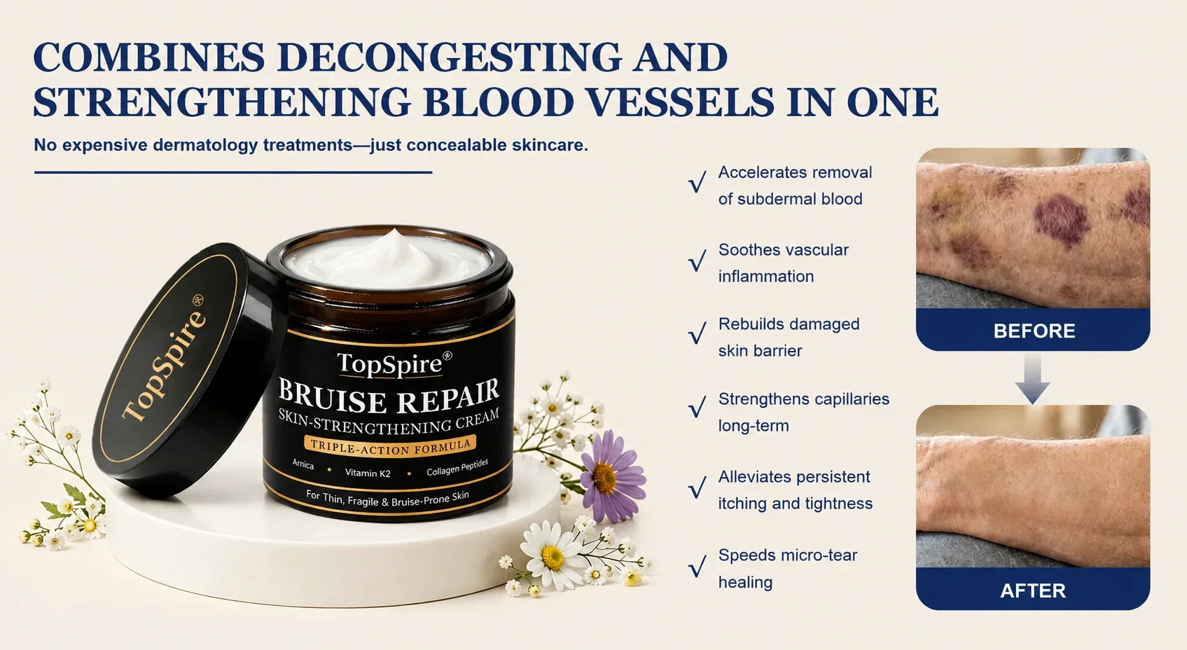 🏆Official US Store🔥TopSpire® Bruise Repair & Skin-Strengthening Cream
