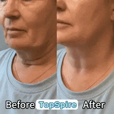 TopSpire® Facility Botox-Inspired Pure Collagen Firming Wand