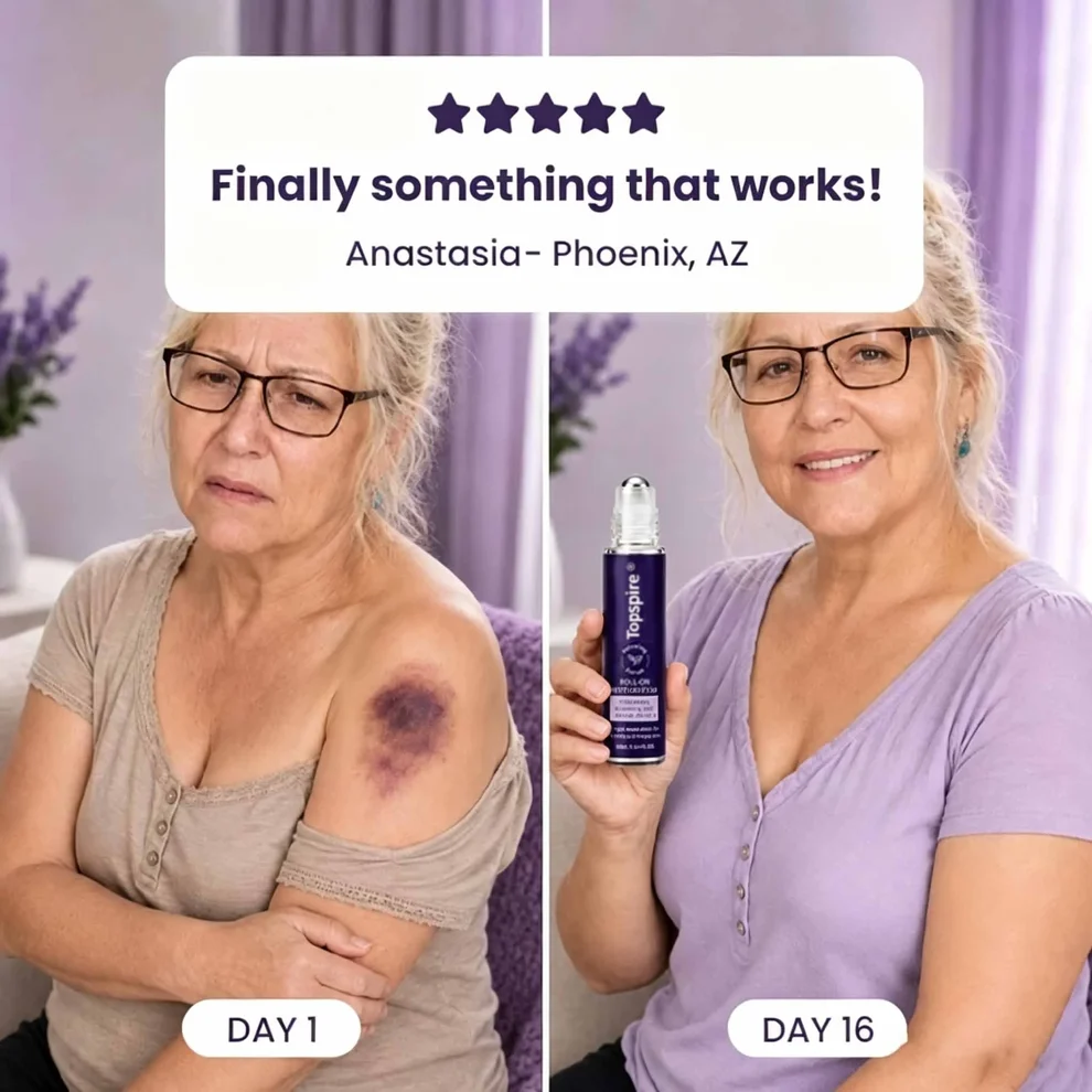 TopSpire® Bruise Repair Roll-On
