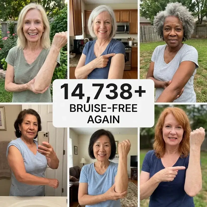 💥300K+ SOLD💕-TopSpire® Bruise Repair & Skin-Strengthening Cream