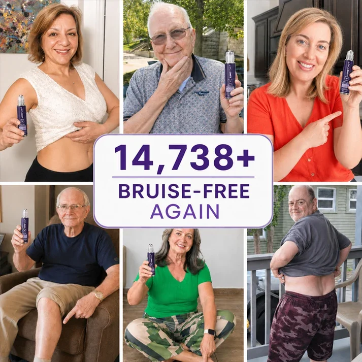 TopSpire® Bruise Repair Roll-On