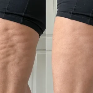 TopSpire® Facility Botox-Inspired Pure Collagen Firming Wand
