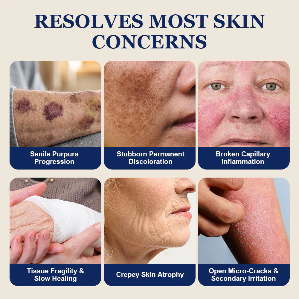 🏆Official US Store🔥TopSpire® Bruise Repair & Skin-Strengthening Cream