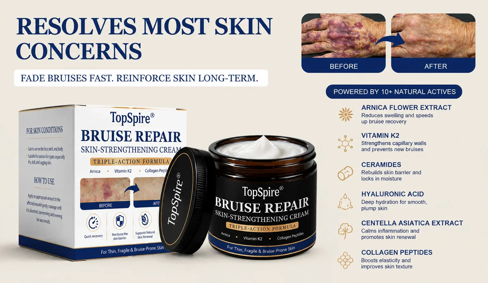 🏆Official US Store🔥TopSpire® Bruise Repair & Skin-Strengthening Cream
