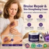 💥75K+ SOLD- TopSpire® Bruise Repair & Skin-Strengthening Cream