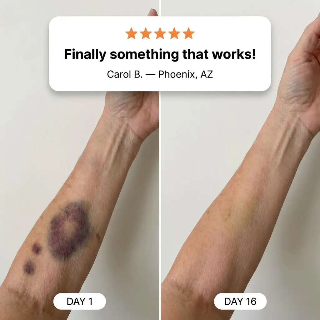 💥75K+ SOLD- TopSpire® Bruise Repair & Skin-Strengthening Cream