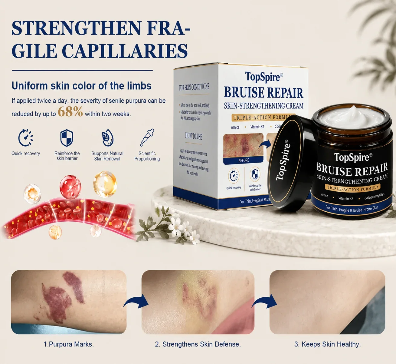 🏆Official US Store🔥TopSpire® Bruise Repair & Skin-Strengthening Cream