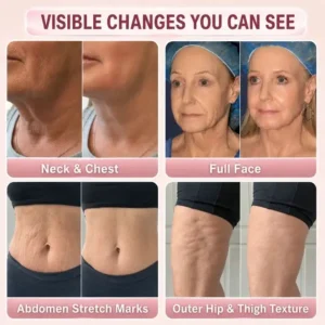 TopSpire ® Facility Botox-Inspired Pure Collagen Firming Wand