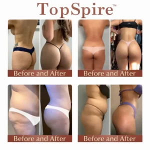 TopSpire™ CurveSculpt Micro-Patch