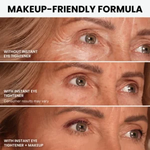TopSpire Instant Eye Tightener
