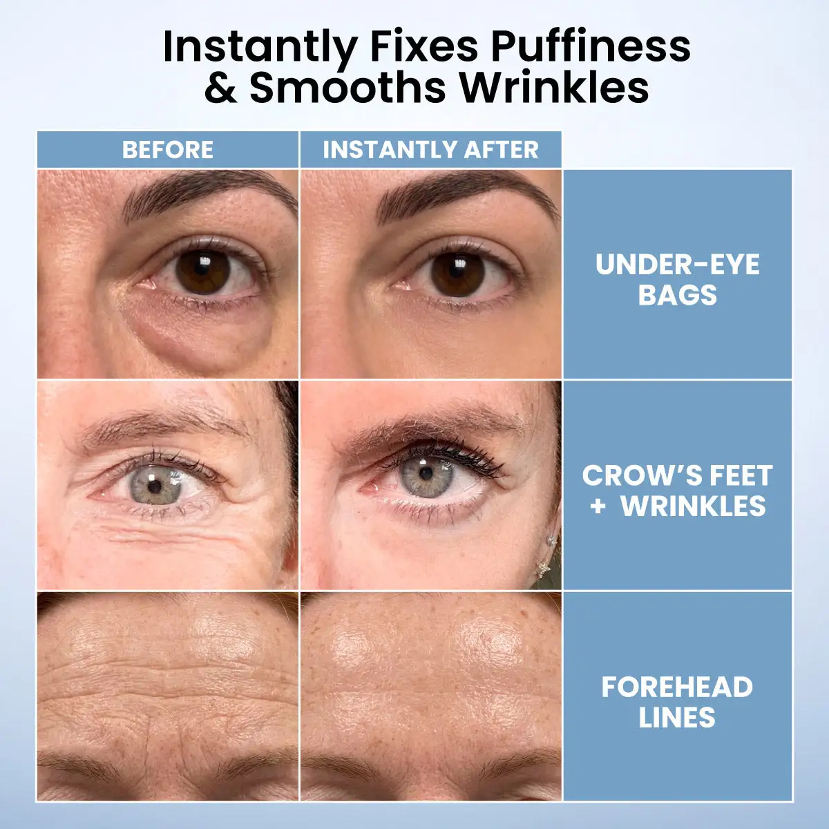 TopSpire Instant Eye Tightener