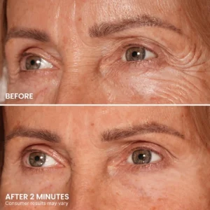 TopSpire Instant Eye Tightener