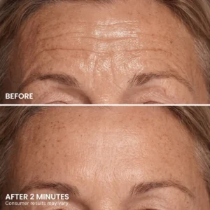 TopSpire Instant Eye Tightener