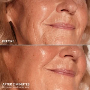 TopSpire Instant Eye Tightener