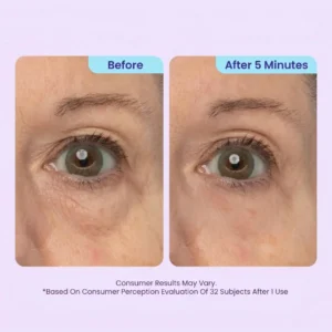 TopSpire™ Instant Lift Eye Gel