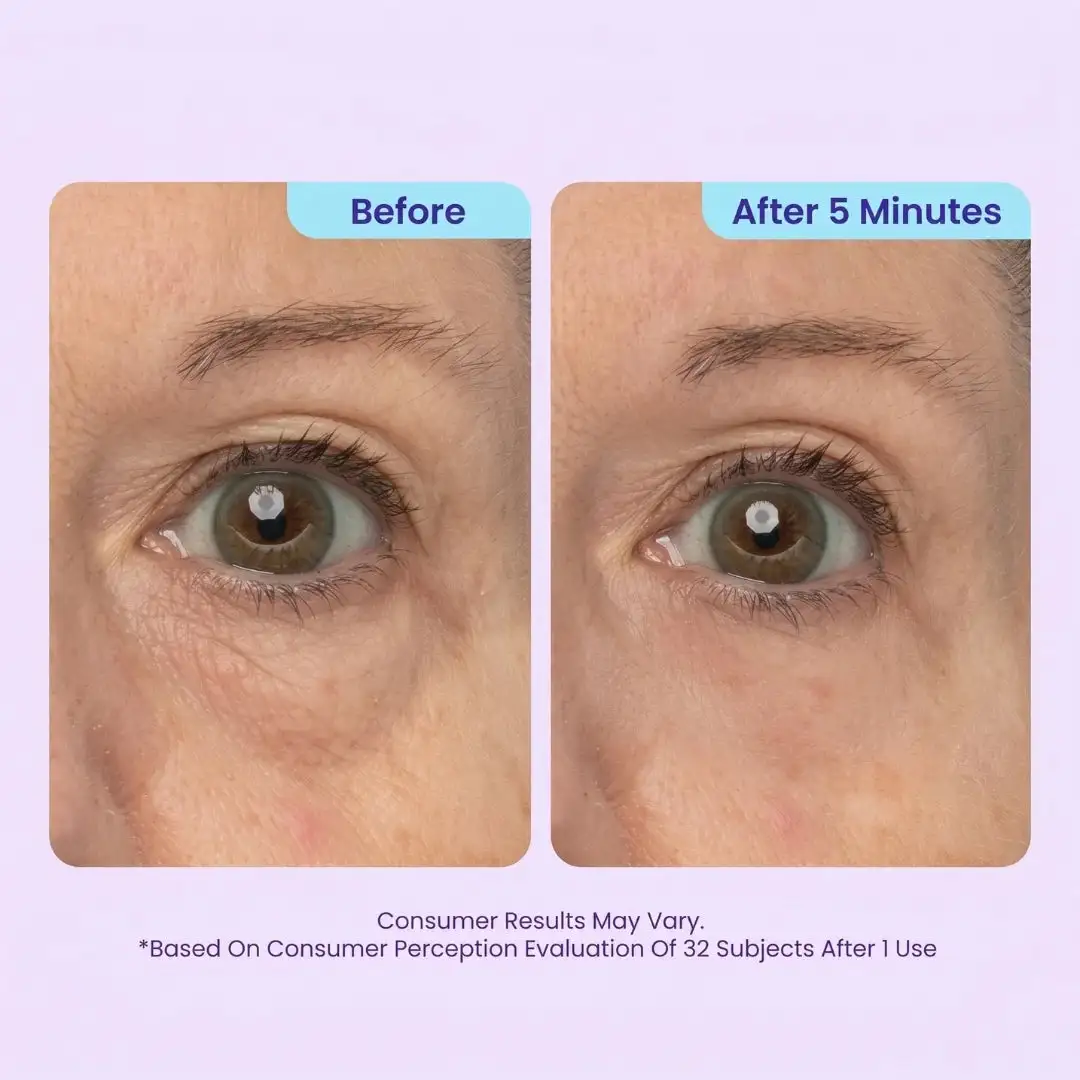 TopSpire™ Instant Lift Eye Gel