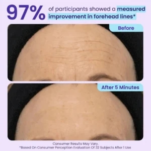 TopSpire™ Instant Lift Eye Gel